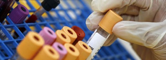 İdrar Analizi Nedir ve Nasıl Yapılır?